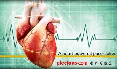 靠心跳供電的起搏器