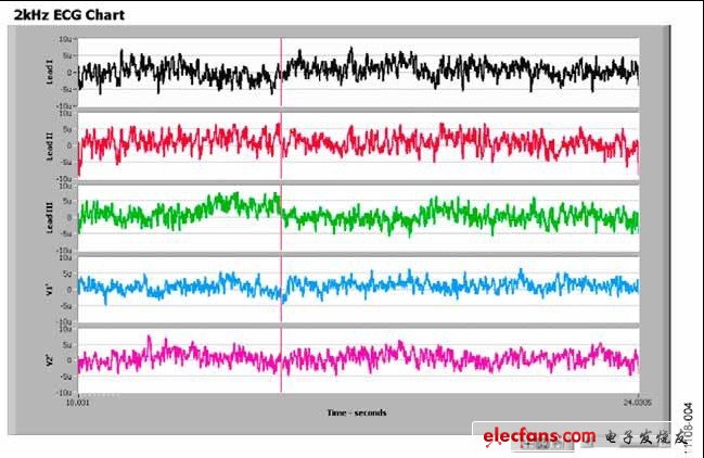 圖4. 使用ADAS1000評估板和評估軟件時導(dǎo)聯(lián)模式下ADAS1000噪聲測量的屏幕截圖