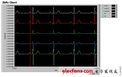 圖3. 連接病人仿真器的ADAS1000屏幕截圖，心率 = 70 BPM