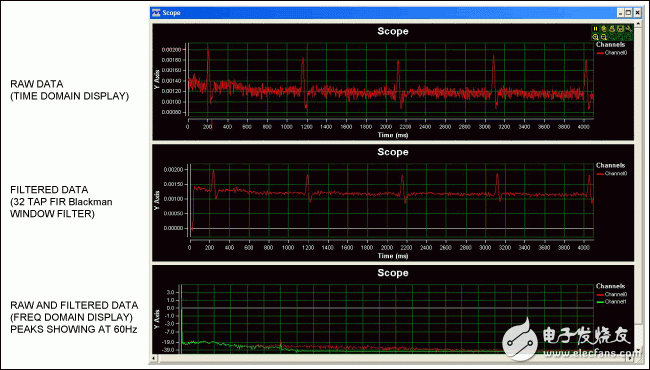 EKG采集數(shù)據(jù)