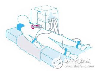 高可靠性心臟監(jiān)護儀設計詳解