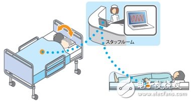 村田智能BCG方案，打造主動健康監(jiān)測