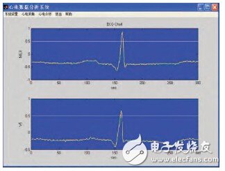 基于生物反饋技術(shù)的可穿戴式心電監(jiān)測系統(tǒng)的設(shè)計