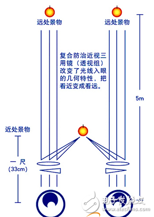 光學預防的定義與防治眼鏡的介紹