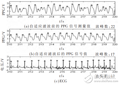 一種基于STM32和PPG技術(shù)的腕戴式心率計設(shè)計