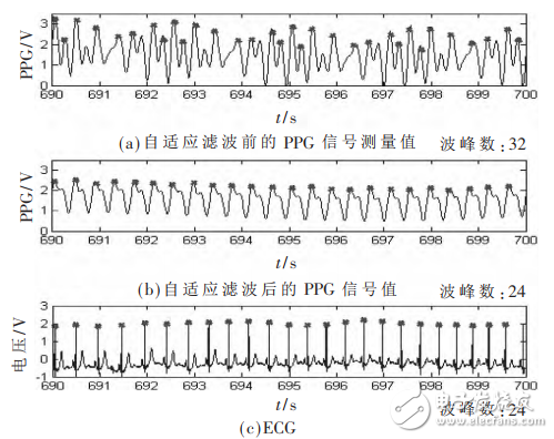 一種基于STM32和PPG技術(shù)的腕戴式心率計設(shè)計