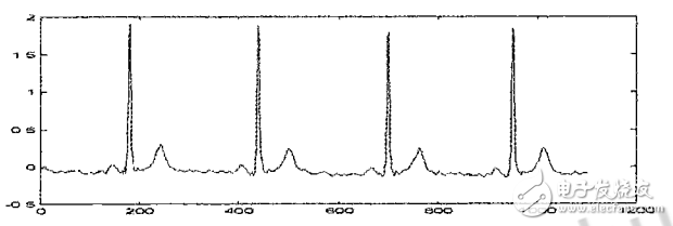 小波閾值去噪的應用