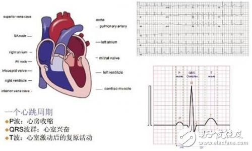 利用ECG AFE簡(jiǎn)化病人監(jiān)護(hù)儀設(shè)計(jì)